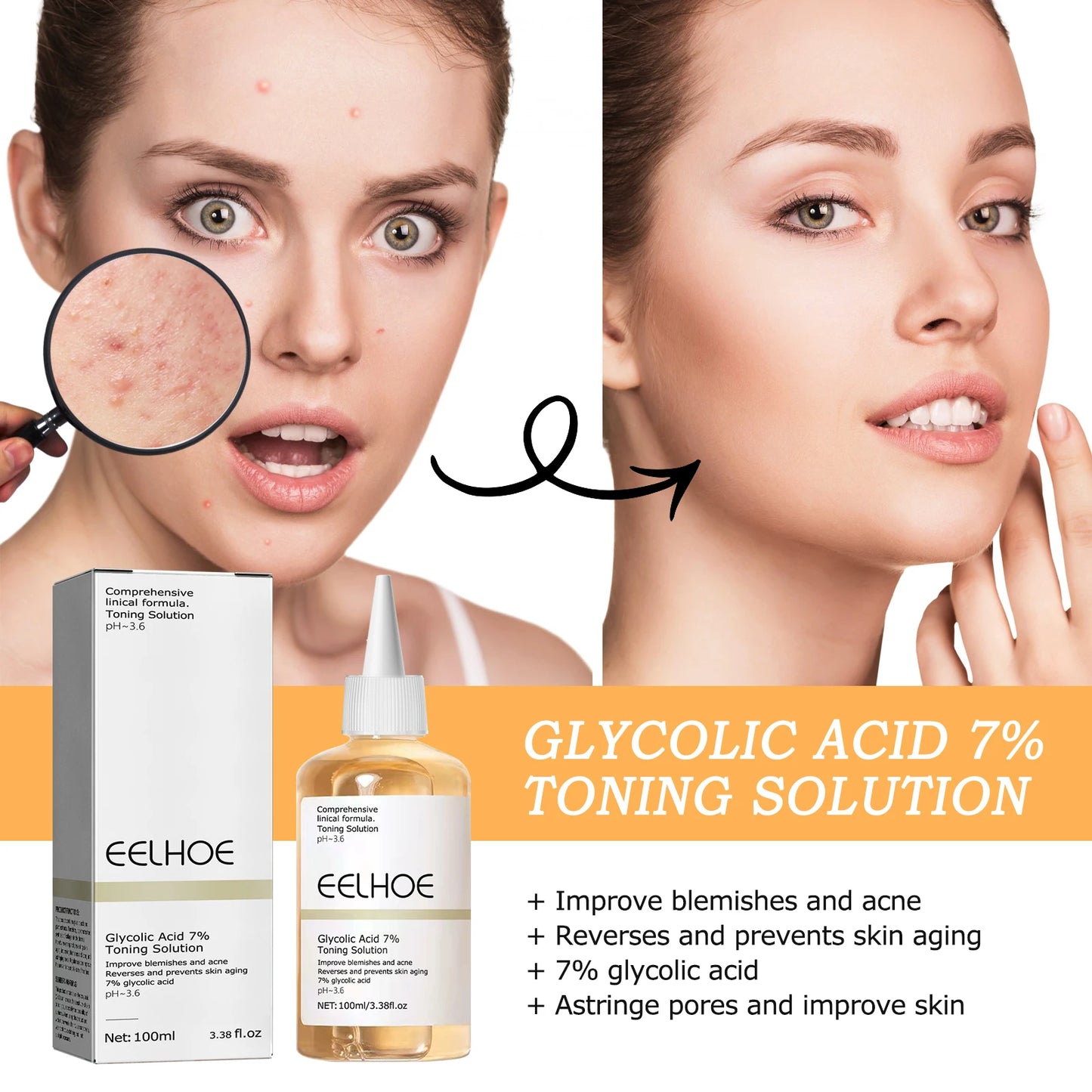 Glycolic Acid Toner 7% Toning Solution Moisturize Smoothing Skin Care Toner