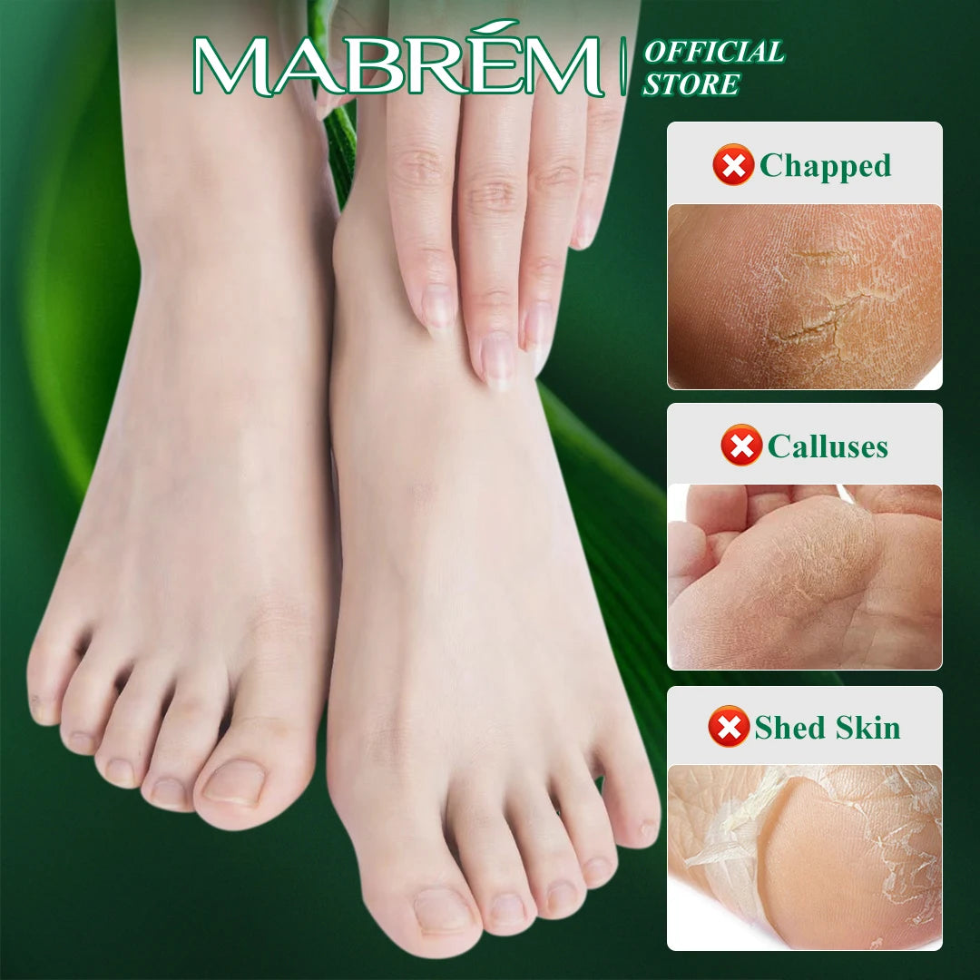 Foot Treatment Cream  Anti-cracking Moisturizing  Protection Cream  Exfoliating Scrub