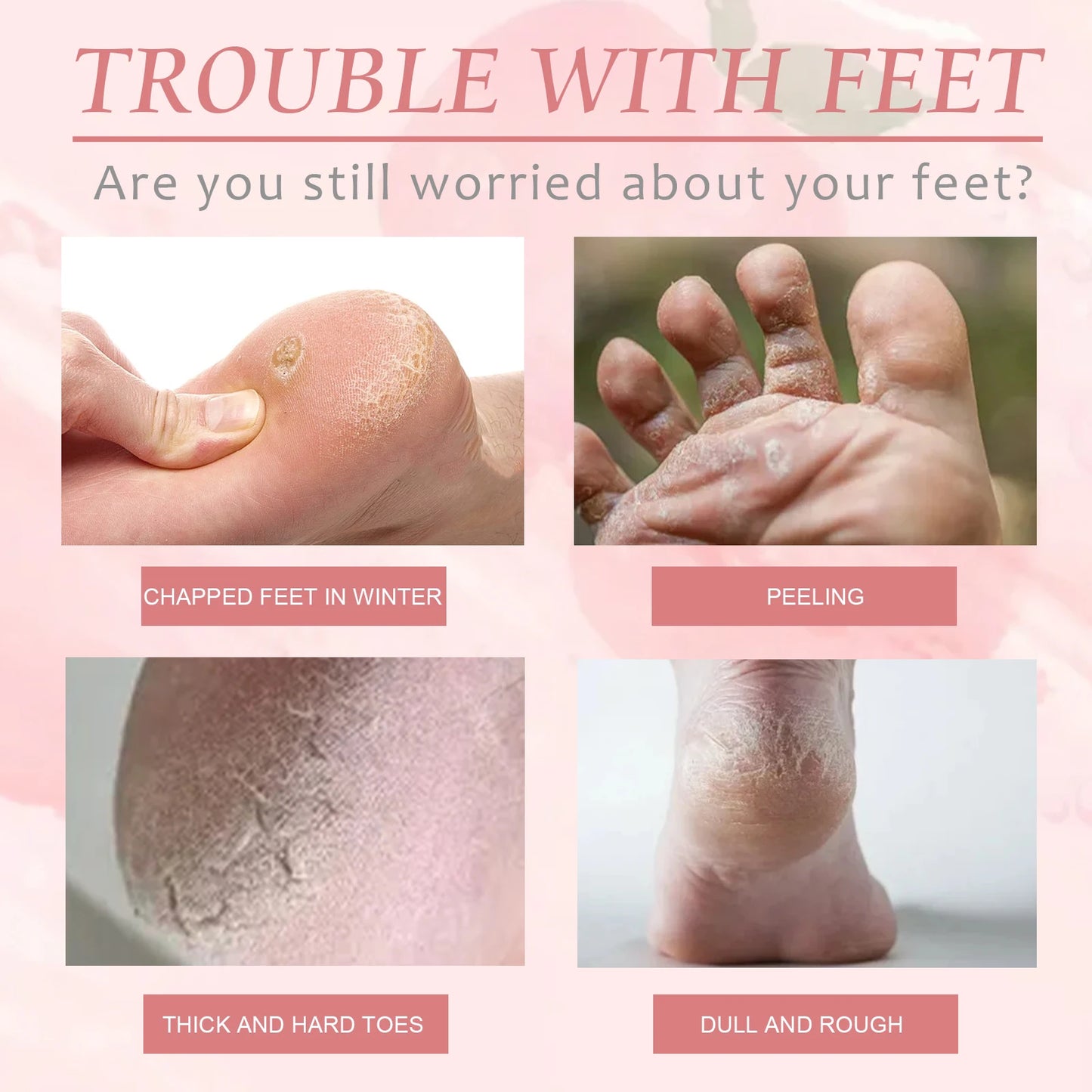 Peach Foot  Moisturizing Foot Mask Remove Dead Skin & Calluses Nourish Feet Care Product