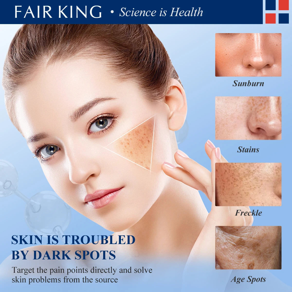 Dark Spot Corrector Skin Fade Cream Lightening Blemish Removal Serum Reduces Age Spots