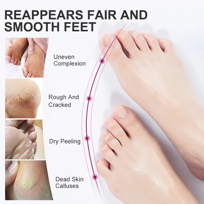 Foot Peel Mask, Exfoliating Peel Off Calluses Dead Skin Callus Remover Dry Cracked Feet, Baby Soft Smooth
