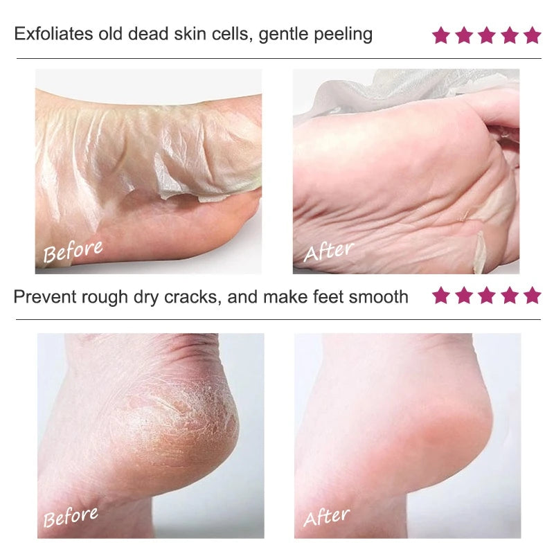 Foot Peel Mask, Exfoliating Peel Off Calluses Dead Skin Callus Remover Dry Cracked Feet, Baby Soft Smooth