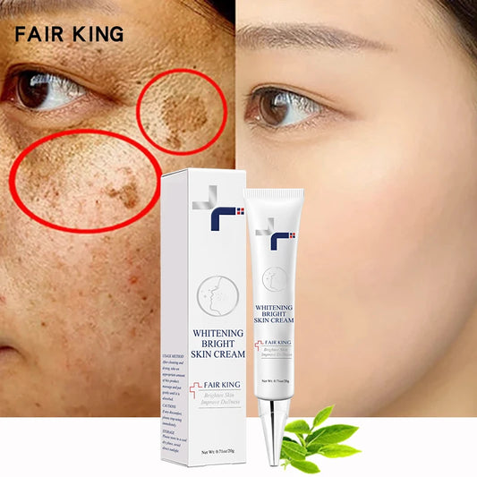 Dark Spot Corrector Skin Fade Cream Lightening Blemish Removal Serum Reduces Age Spots