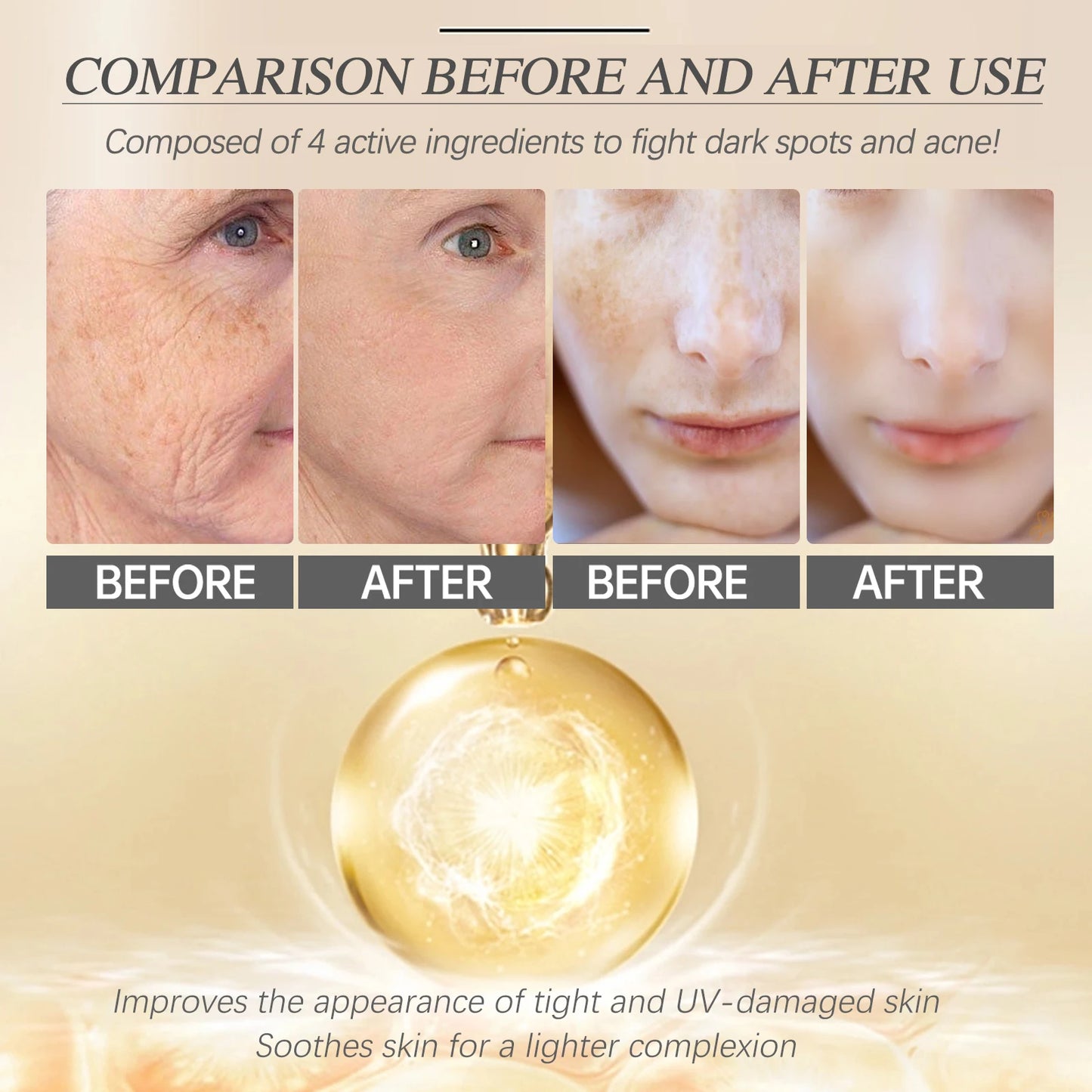 Retinol Face Serum Facial Dark Spot Remover Moisturizer Smooth Skin