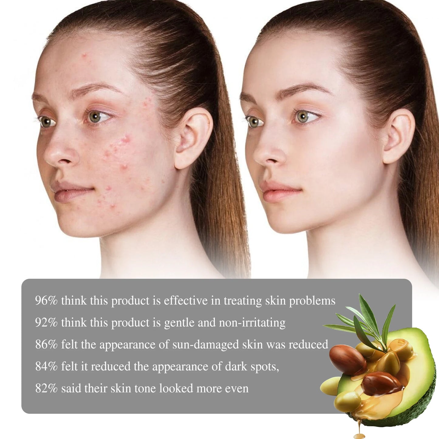 Retinol Face Serum Facial Dark Spot Remover Moisturizer Smooth Skin