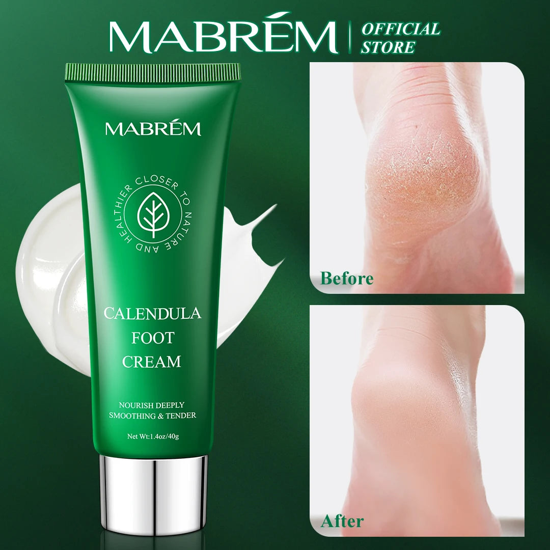 Foot Treatment Cream  Anti-cracking Moisturizing  Protection Cream  Exfoliating Scrub