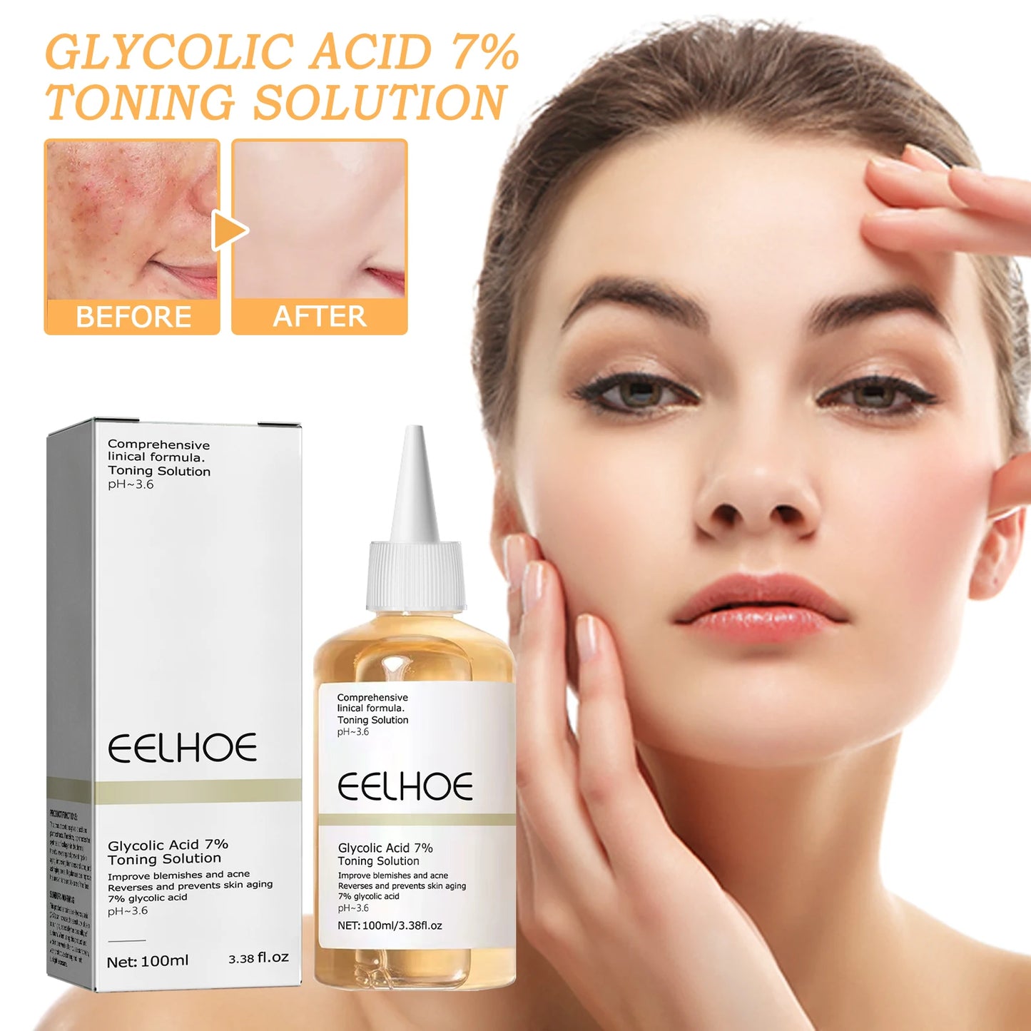 Glycolic Acid Toner 7% Toning Solution Moisturize Smoothing Skin Care Toner