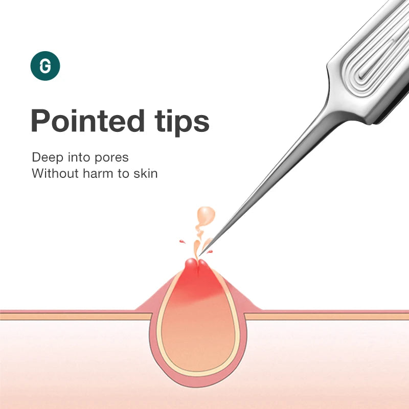 Ingrown Hair Tweezers Needle Nose Pointed Tips Eyebrows Tweezers
