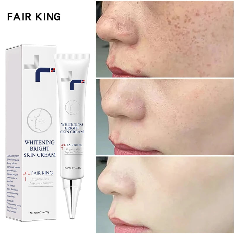Dark Spot Corrector Skin Fade Cream Lightening Blemish Removal Serum Reduces Age Spots