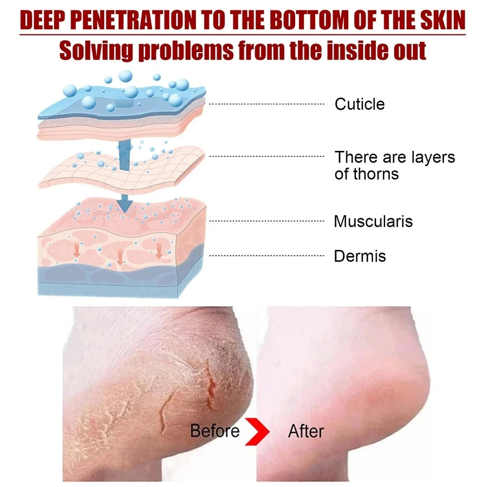 Peeling Foot Mask Repairs Heels & Removes Dry Dead Skin Feet Exfoliating