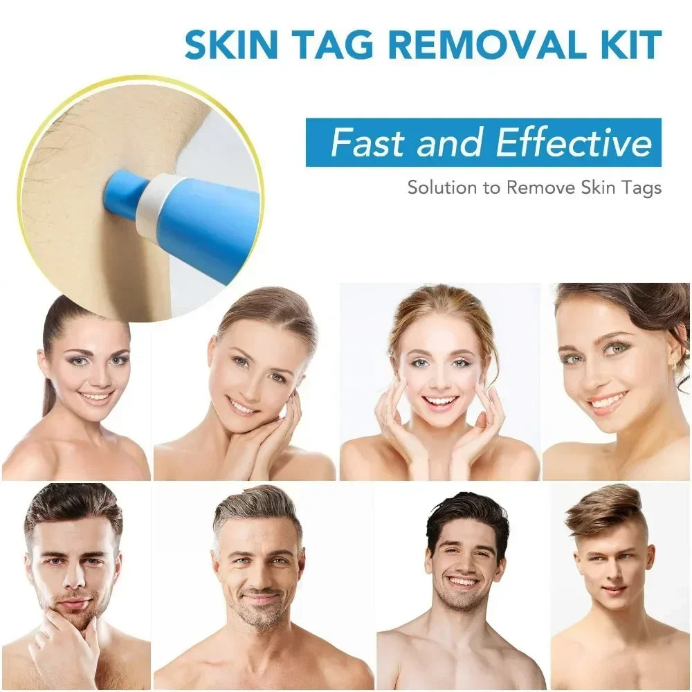 2 In1 Painless Auto Skin Tag Mole Wart Removal Kit  Face Skin Care