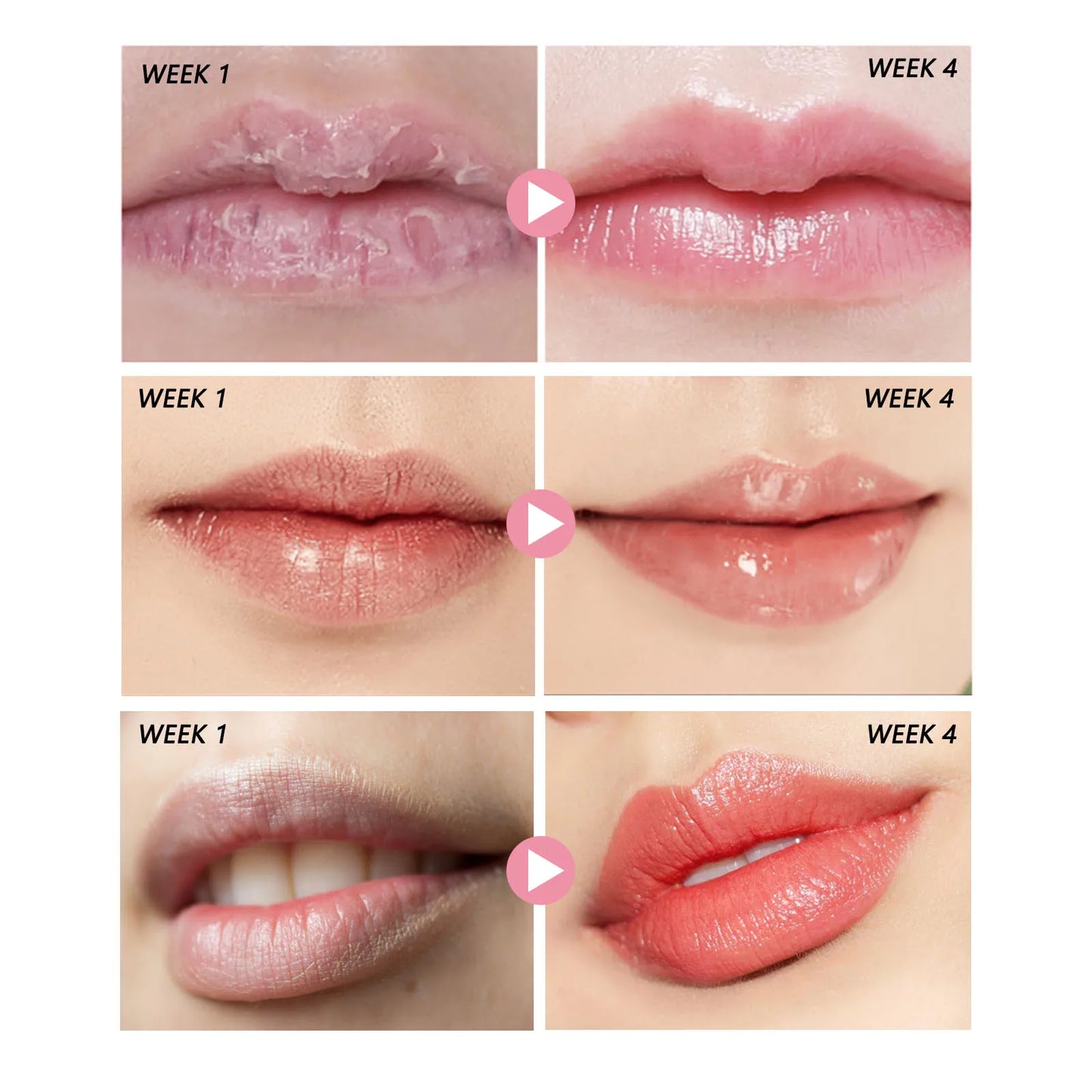 Pink Lips Scrub Exfoliator Dead Skin Removal  Fade Lip Lines Anti Dryness