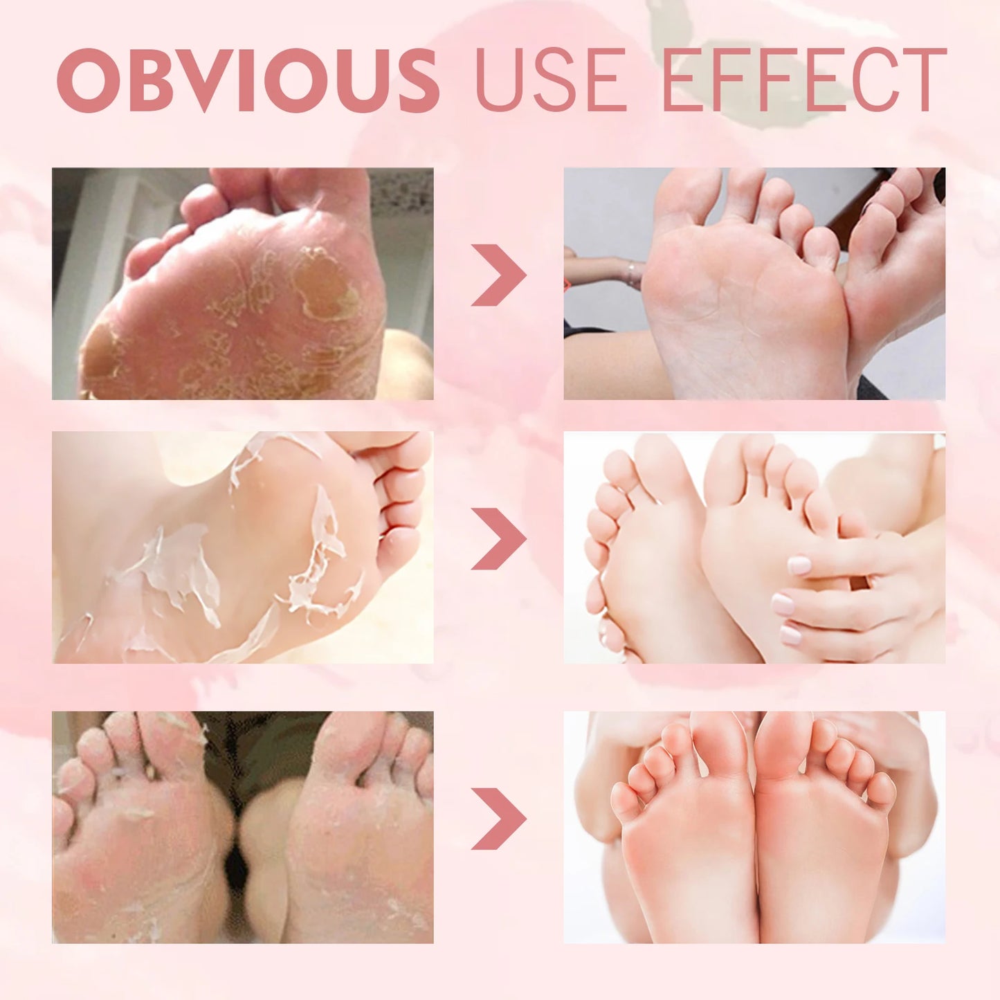 Peach Foot  Moisturizing Foot Mask Remove Dead Skin & Calluses Nourish Feet Care Product