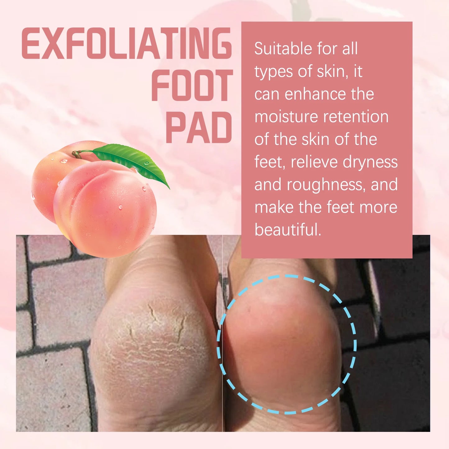 Peach Foot  Moisturizing Foot Mask Remove Dead Skin & Calluses Nourish Feet Care Product