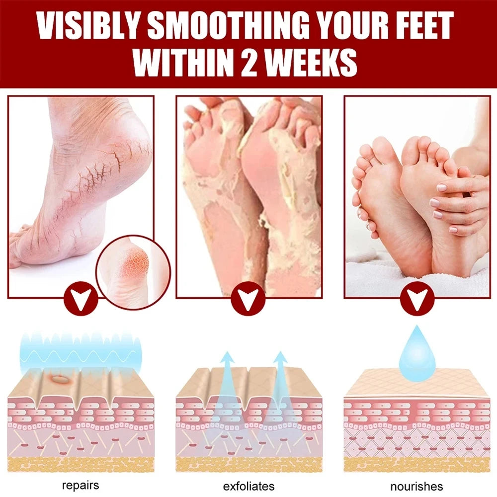 Peeling Foot Mask Repairs Heels & Removes Dry Dead Skin Feet Exfoliating