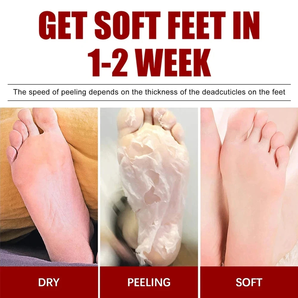 Peeling Foot Mask Repairs Heels & Removes Dry Dead Skin Feet Exfoliating